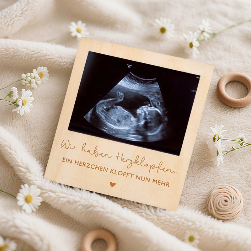Ultrasound Pregnancy Announcem - Photography Prompt review and price