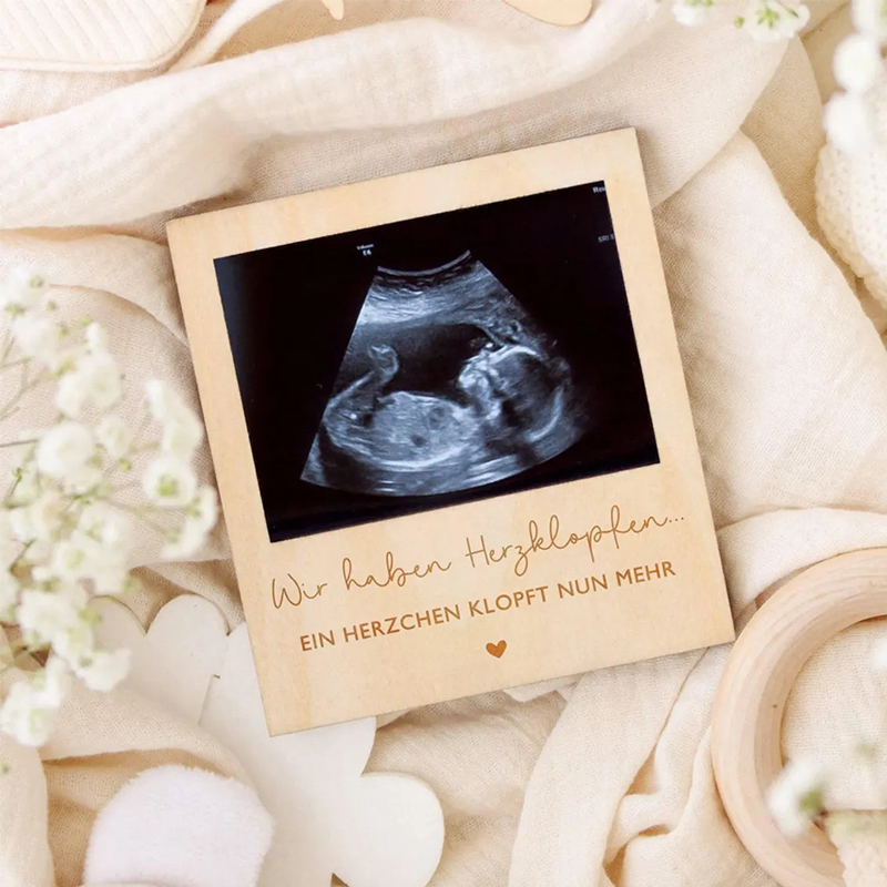 Ultrasound Pregnancy Announcem - Photography Prompt review and price
